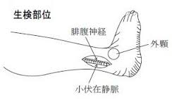 神経生検（腓腹神経生検術）の部位